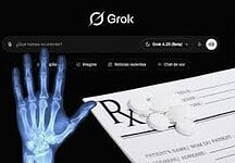 Privacidad en riesgo: ¿Es seguro subir tus datos médicos a Grok, la IA de Elon Musk?